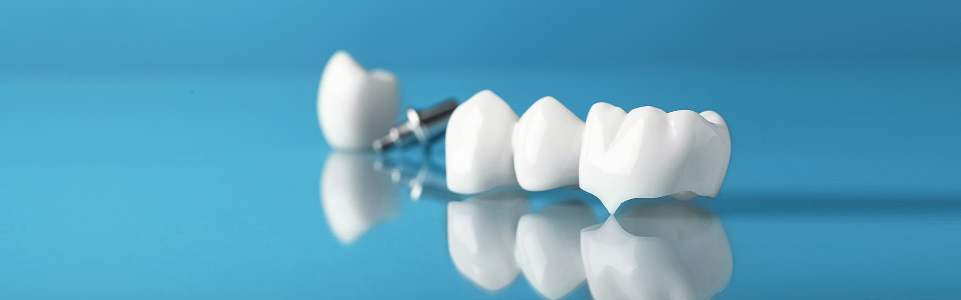 Caring for Your Dental Bridge: Tips for Maintaining Your Oral Health